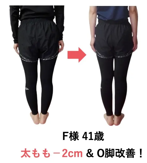 N・Fさまのビフォーアフター