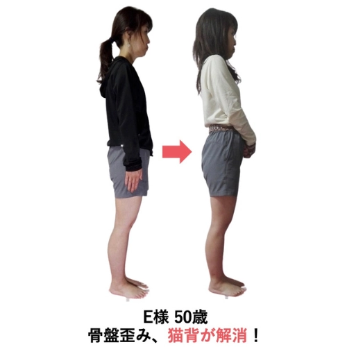 Eさまビフォーアフター
