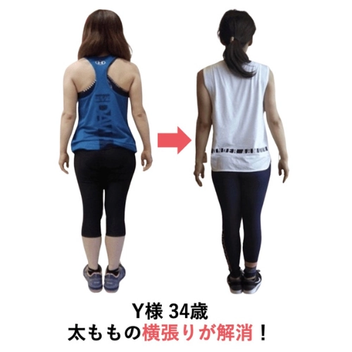 Yさまのビフォーアフター