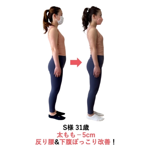Sさまビフォーアフター